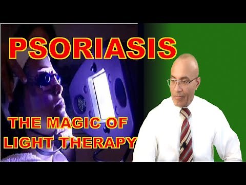 Psoriasis Treatment (How Light Therapy Works)