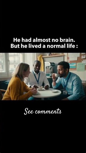 He Lived Almost Without a Brain 🧠😳 #Neuroscience #BrainFacts #science