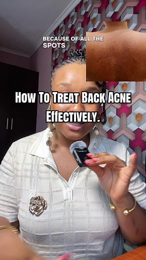 Effective Treatments for Back Acne and Skincare Tips