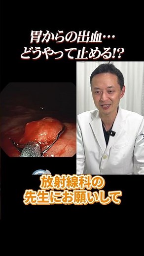 What happens if you have a polyp in your stomach? A live commentary on the moment the bleeding st...