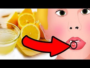 Natural Cures for Mucocele (Mucous Cyst) - How I treat it