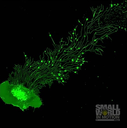Migrasome Formation in L929 Cell | 2017 #NikonSmallWorld #Microscopy