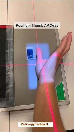 Thumb AP X -ray # Thumb lateral view X-ray #radiography #radiology #radiographer