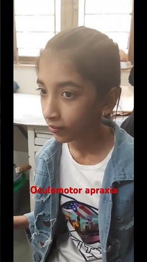 Oculomotor apraxia #neurology #clinical #brain