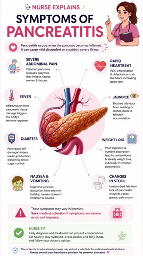 ⚠️ Pancreatitis Symptoms You Should Never Ignore / Nurse Explains #nurseexplains #medicalfacts