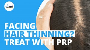 While hair loss can happen for various reasons, PRP is a special procedure to treat people facing a thinning hairline and hair fall due to diffused hair loss. Platelet-rich plasma is an effective procedure that responds well to people facing hair fall concerns performed by various trichologists worldwide. As more accessible as it may sound, it also comes without any side effects. And the downtime is also not much, so the treatment is now a go-to solution for people facing hair loss issues. For A
