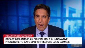 How breast implants helped save a man with severe lung damage | CNN