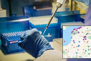 CARTE. Coronavirus : tout savoir sur les tests de dépistage (PCR ou sérologiques) proposés dans les Hauts-de-France