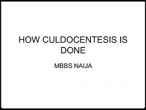 How is Culdocentesis Done / Step by step how Culdocentesis procedure is performed (Culdoscopy)