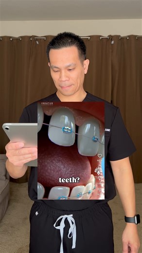 Understanding How Braces Move Teeth Effectively