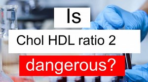 Treatment and symptoms of Chol HDL ratio 2 Ratio | Diet for low Cholesterol HDL ratio level 2 Ratio
