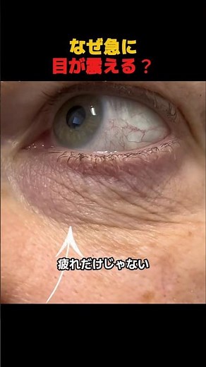 Why Does Your Eye Suddenly Twitch?