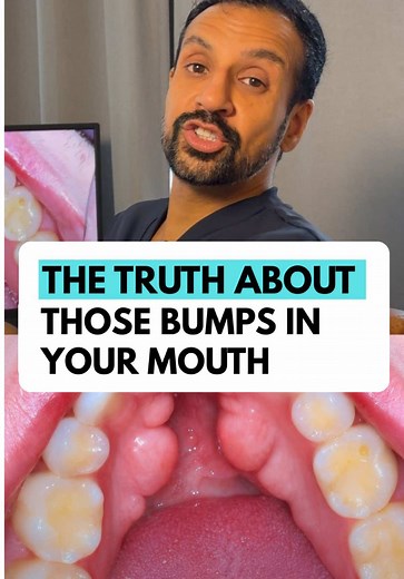 Lumps and bumps under tongue: when your dentist might be wrong