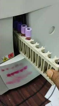 HbA1c test processing in D-10 full auto analyzer | Bio-Rad instrument | #hematology #hba1c #d10