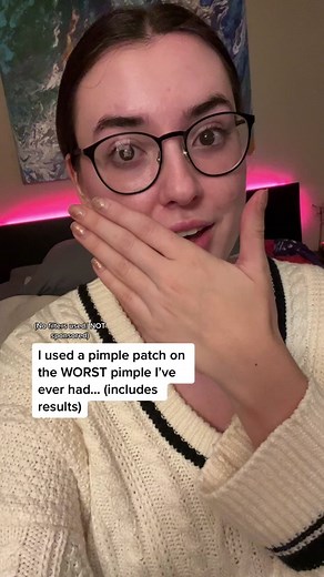 Mighty Hero Acne Patch Review: Satisfying Pimple Removal