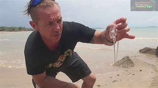 Box jellyfish sting pain levels explained with critical cone shell first aid techniques