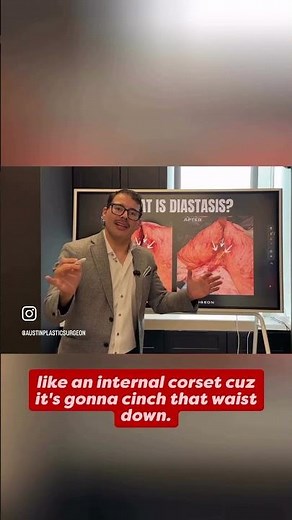 What is diastasis and how can we fix it? 👇