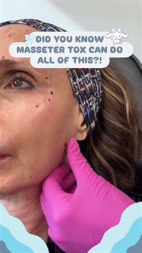 Did You Know Masseter Tox Can Do All This?!