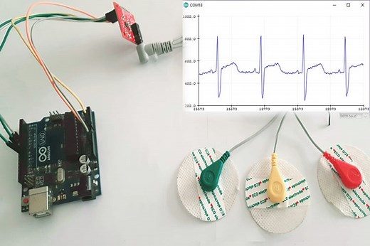 Understating ECG Sensors and How to Program one to Diagnose Various Medical Conditions
