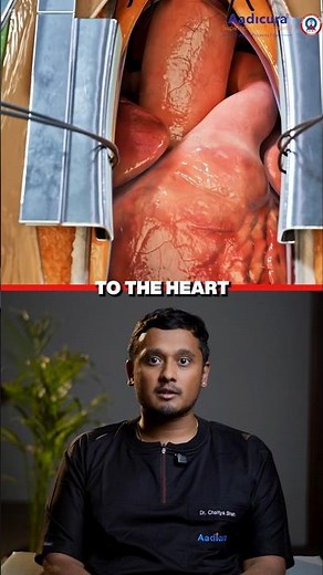 How Doctors Stop The Heart During Surgery