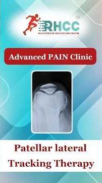Fix Patellar Lateral Tracking - Reduce Knee Pain by Kinesiology Tapping. #physiotherapist