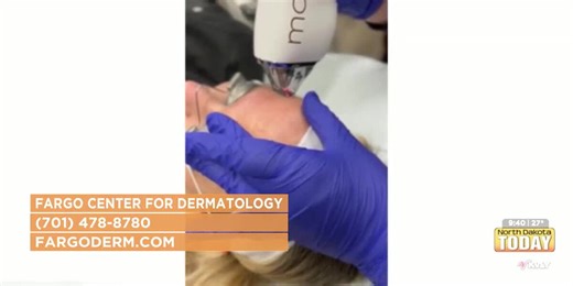 North Dakota Today- Fargo Center for Dermatology