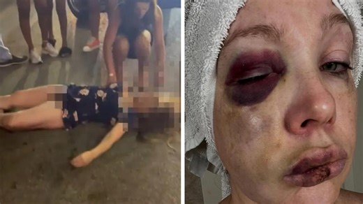 ‘They asked for that beat down’: Man and woman bashed by mob in horrifying viral footage