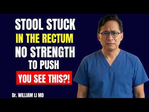 Stool Stuck in the Rectum! What is it and what to do? | Proctologist Explains