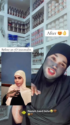7-Day Skincare Transformation: Before & After