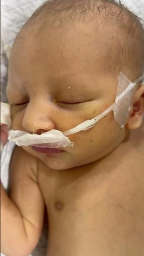 Setting oxygen pipe in baby nose| expert baby care #babycare #nasalcare #oxygenceuticals