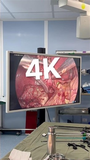 Kaise Hoti hai - 4K LAPAROSCOPIC Surgery in India I Surat I Gujarat