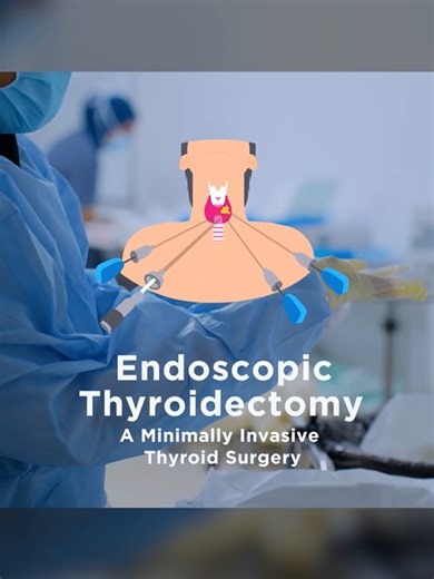 Minimally Invasive Endoscopic Thyroid Surgery Explained