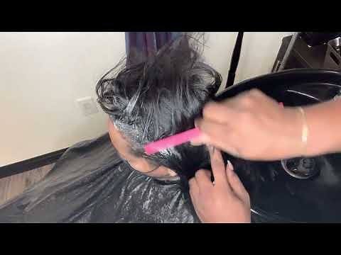 How to remove dandruff from the scalp easy| How to remove seborrheic dermatitis