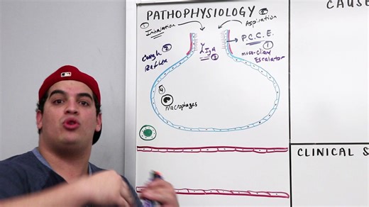 Ninja Nerd 肺炎 病理生理