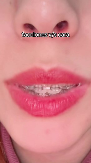 Feas facciones fea cara