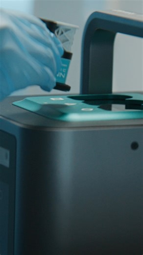 🤝 Meet your patients’ growing demands for single-visit restorations. The Straumann Chairside Workflow with Straumann Signature Midas by SprintRay makes it easy to deliver on that expectation. Thanks to the Straumann AXS™ platform, every step is connected, so you can focus on what truly matters: your patients. Watch the video to see the workflow in a clinical setting and experience how digital dentistry fits effortlessly into your routine. Learn more via https://brnw.ch/21wXm5F | Straumann