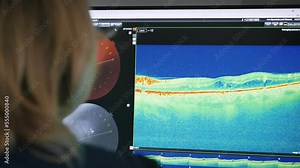 Ophthalmologist doctor analyzing eye vision exams results, looking at monitor