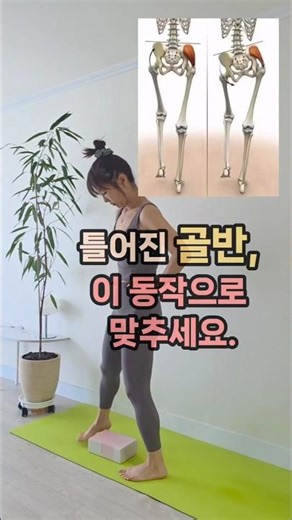 틀어진 골반, 이 3가지로 바로 잡습니다.
