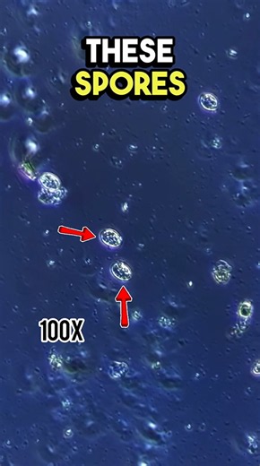What plant fungus really looks like under a microscope