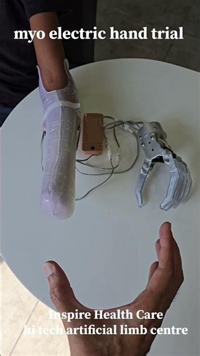 Myoelectric Prosthetic Hand | Inspire Healthcare Rajkot