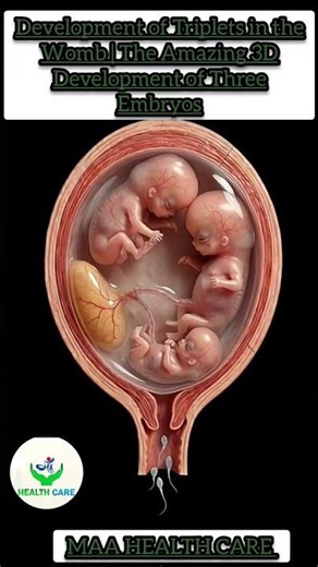 Development of Triplets in the Womb | The Amazing 3D Development of Three Embryos #umbilical #fetalb