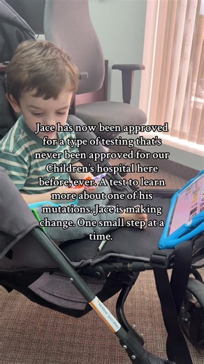 31K views · 443 reactions | This is called an episign test. It’s...