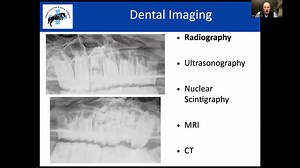 Webinar HDE - Advanced Imaging in Dental and Sinus Disease - Neil Townsend
