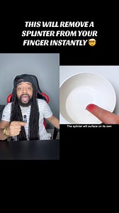 1.7M views · 14K reactions | This will remove a splinter from your finger instantly 勞 #lifehacks | Lifesbook_ceo | Facebook