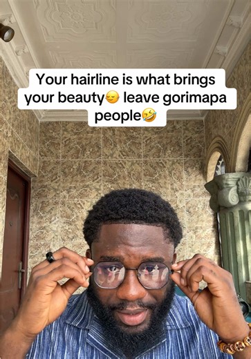 Don’t allow anybody whine you..being bald is not attractive at a young age😂 that’s what bald people use to console theirselves..if you notice you are receeding hop on minoxidil early stages Before your hair concern gets really bad and thank me later🤝 #minoxidil #minoxidilresult #balding #minoxidilkirkland