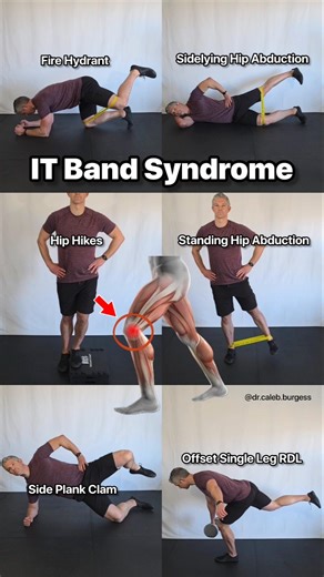 IT Band - Rehab Exercises - Lateral Knee Pain