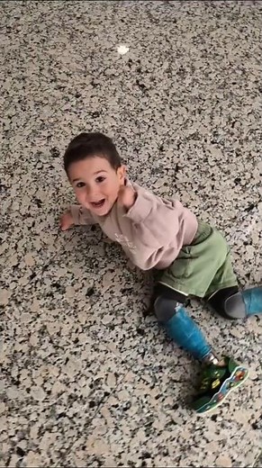 Born Without Limbs, But Nothing Can Stop Him | Inspiring Prosthetic Journey | Disable Life