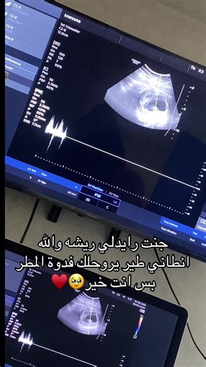 بشارة بمولد الصبي ودعوة للتفاؤل