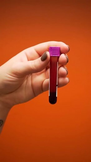 How to perform a manual platelet count in vet med via @all_star_veterinary_clinic . . . . . . . #vetmed #veterinarymedicine #vetschool #veterinarytechnician #vetstudent #animalhealth #cbc #instadaily #animallovers #veterinarycoaching #labtechnician | Vet Candy
