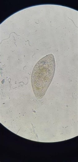 Terus berputar putar😇 dalam kolam ikan #microscope #biology #undermicroscope #fypyoutube